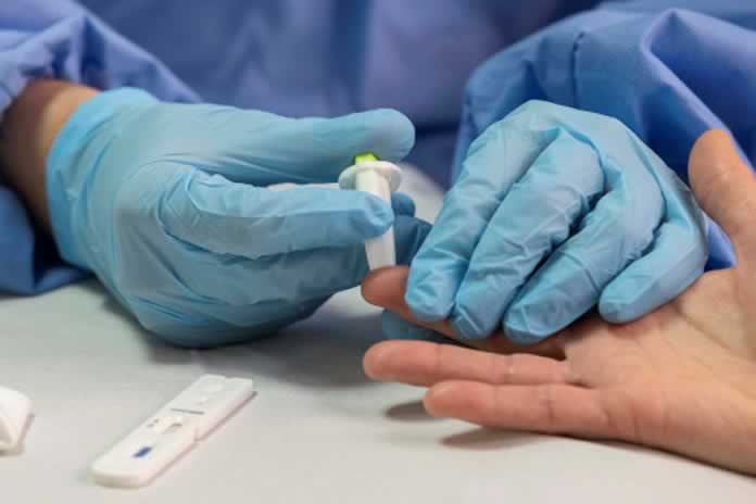 42CC-COVID 19 MILES DE TEST DEFECTUOSOS FUE ENVIADOS POR UN LABORATORIO CHINO