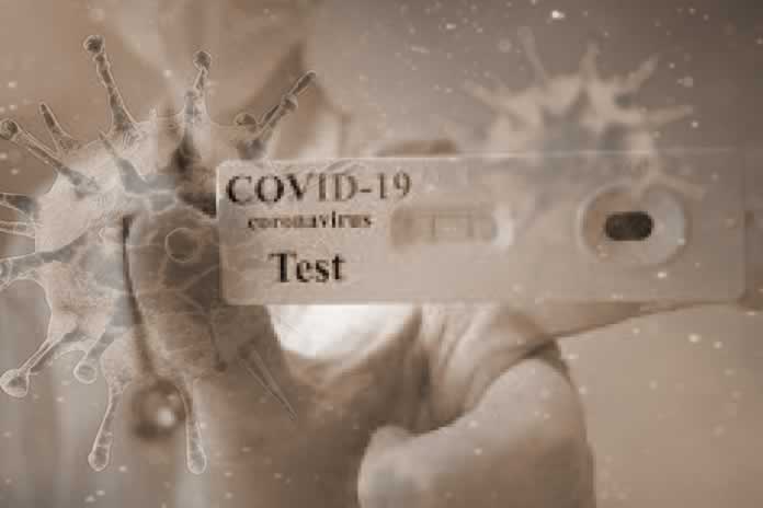 146P- Covid 19. De derrotas y aprendizajes....1